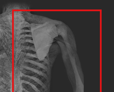 APR human x-ray  icon