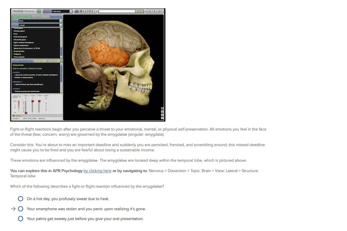 Visualized Brain Image Example