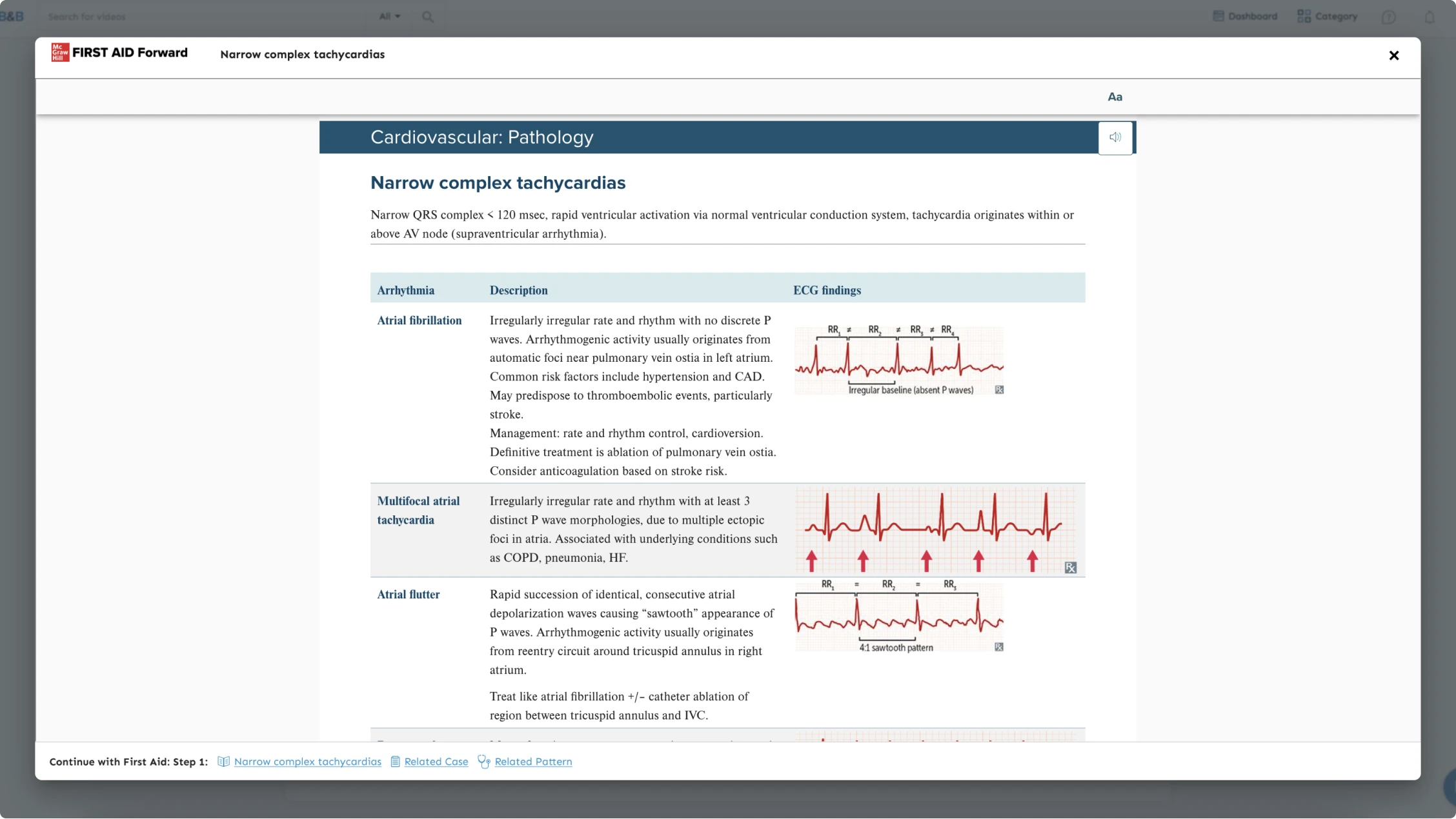 A pop-up window inside the platform that is displaying links on the bottom to the topic narrow complex tachycardia related to atrial fibrillation with additional links to related cases and patterns.  