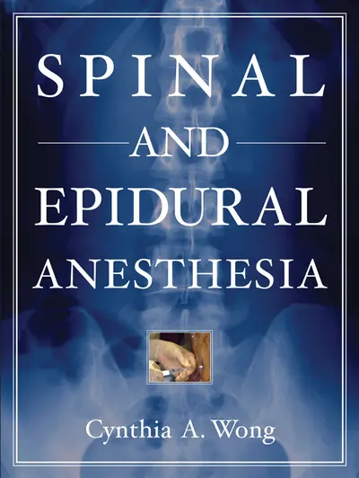 Spinal and Epidural Anesthesia Spinal and Epidural Anesthesia