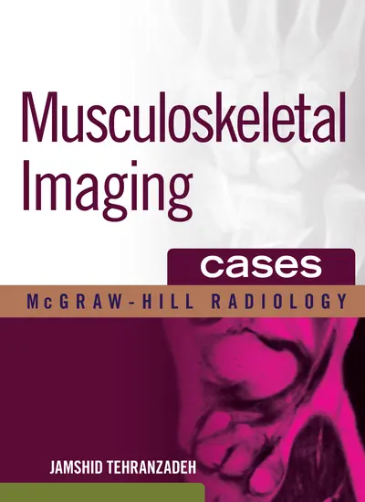 Musculoskeletal Imaging Cases Musculoskeletal Imaging Cases