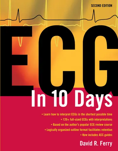 ECG in Ten Days: Second Edition ECG in Ten Days: Second Edition