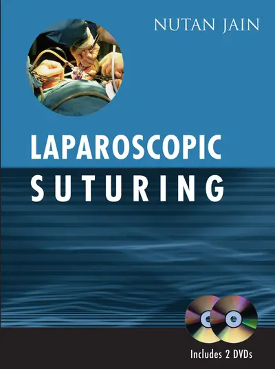 Laparoscopic Suturing Laparoscopic Suturing