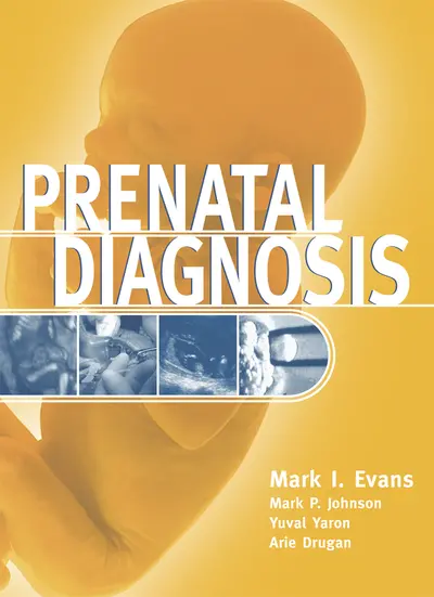 Prenatal Diagnosis Prenatal Diagnosis