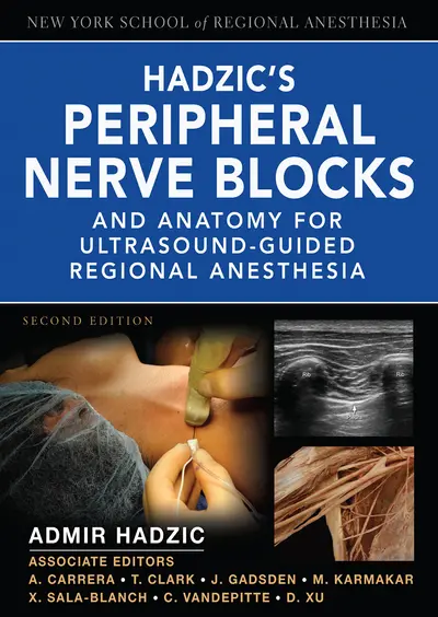 Hadzic's Peripheral Nerve Blocks and Anatomy for Ultrasound-Guided Regional Anesthesia Hadzic's Peripheral Nerve Blocks and Anatomy for Ultrasound-Guided Regional Anesthesia