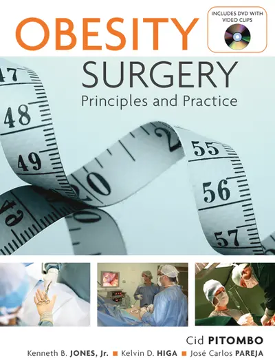 Obesity Surgery: Principles and Practice Obesity Surgery: Principles and Practice