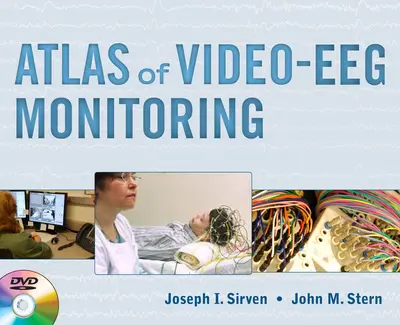 Atlas of Video-EEG Monitoring Atlas of Video-EEG Monitoring