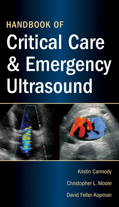 Handbook of Critical Care and Emergency Ultrasound Handbook of Critical Care and Emergency Ultrasound