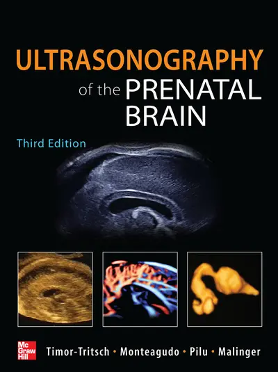 Ultrasonography of the Prenatal Brain, Third Edition Ultrasonography of the Prenatal Brain, Third Edition