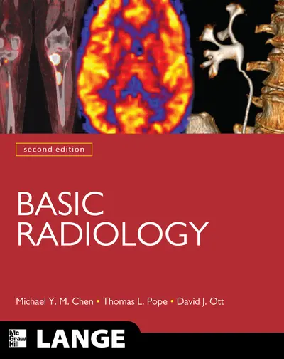 Basic Radiology, Second Edition Basic Radiology, Second Edition