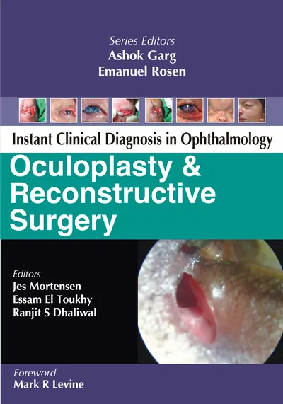 Oculoplasty and Reconstructive Surgery Oculoplasty and Reconstructive Surgery
