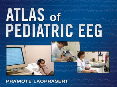 Atlas of Pediatric EEG Atlas of Pediatric EEG