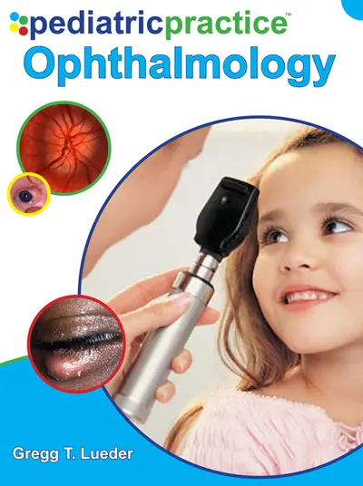 Pediatric Practice Ophthalmology Pediatric Practice Ophthalmology