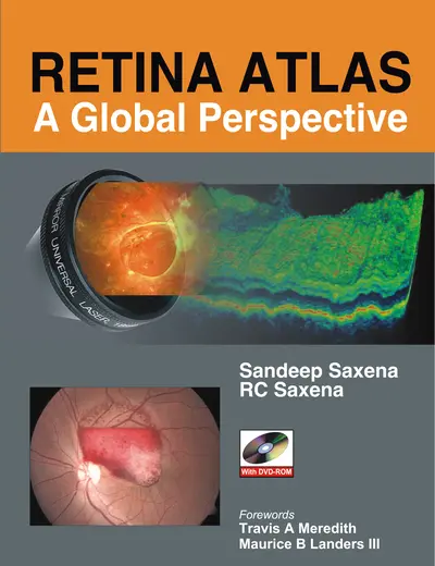 Retina Atlas: A Global Perspective Retina Atlas: A Global Perspective