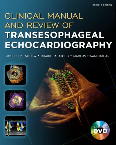 Clinical Manual and Review of Transesophageal Echocardiography, Second Edition