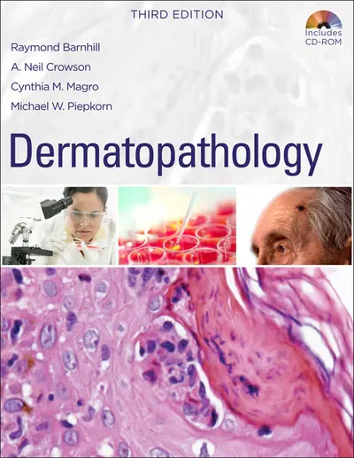 Dermatopathology: Third Edition Dermatopathology: Third Edition