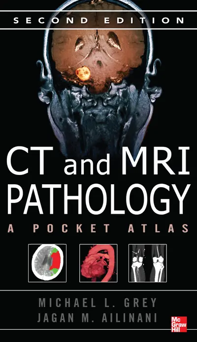 CT & MRI Pathology: A Pocket Atlas, Second Edition CT & MRI Pathology: A Pocket Atlas, Second Edition