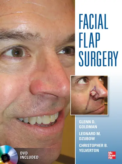 Facial Flaps Surgery Facial Flaps Surgery