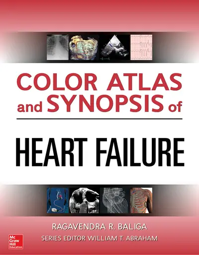 Color Atlas and Synopsis of Heart Failure Color Atlas and Synopsis of Heart Failure