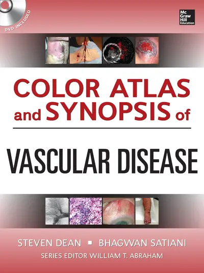Color Atlas and Synopsis of Vascular Disease Color Atlas and Synopsis of Vascular Disease