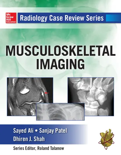 Radiology Case Review Series: MSK Imaging Radiology Case Review Series: MSK Imaging