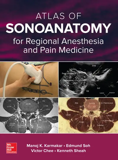 Atlas of Sonoanatomy for Regional Anesthesia and Pain Medicine Atlas of Sonoanatomy for Regional Anesthesia and Pain Medicine