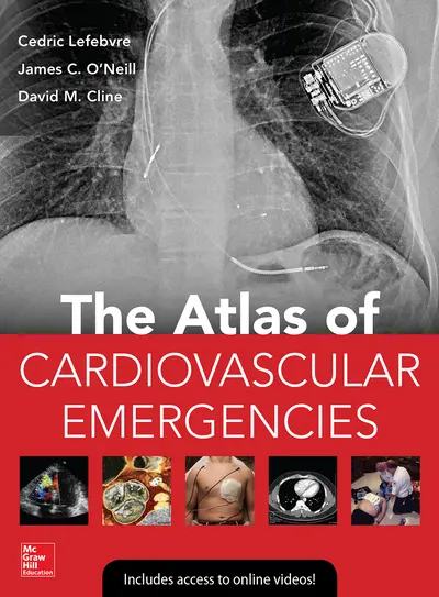 Atlas of Cardiovascular Emergencies Atlas of Cardiovascular Emergencies