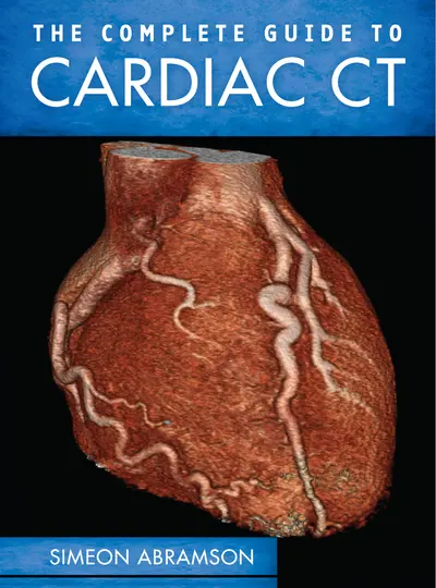 The Complete Guide to Cardiac CT The Complete Guide to Cardiac CT