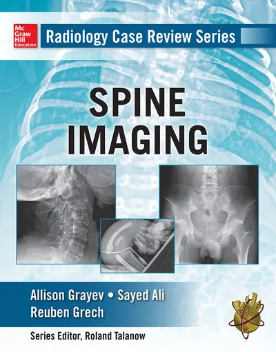 Radiology Case Review Series: Spine Radiology Case Review Series: Spine