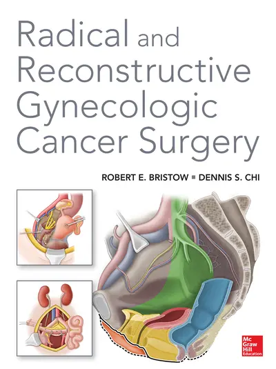 Radical and Reconstructive Gynecologic Cancer Surgery Radical and Reconstructive Gynecologic Cancer Surgery