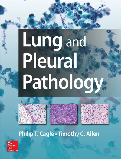 Lung and Pleural Pathology Lung and Pleural Pathology