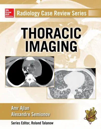 Radiology Case Review Series: Thoracic Imaging Radiology Case Review Series: Thoracic Imaging