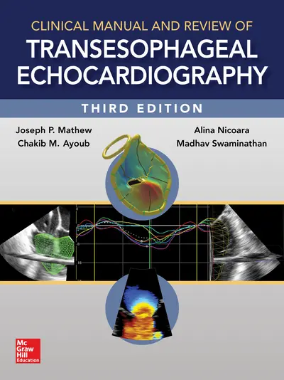 Clinical Manual and Review of Transesophageal Echocardiography, 3/e Clinical Manual and Review of Transesophageal Echocardiography, 3/e