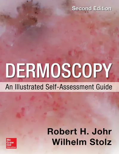 Dermoscopy: An Illustrated Self-Assessment Guide, 2/e Dermoscopy: An Illustrated Self-Assessment Guide, 2/e