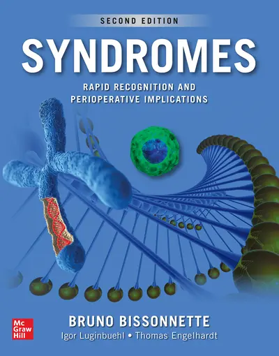 Syndromes: Rapid Recognition and Perioperative Implications, 2nd edition