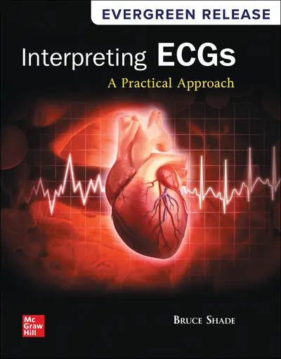 Connect Online Access 1 semester for Interpreting ECGs: A Practical Approach 3rd edition Connect Online Access 1 semester for Interpreting ECGs: A Practical Approach