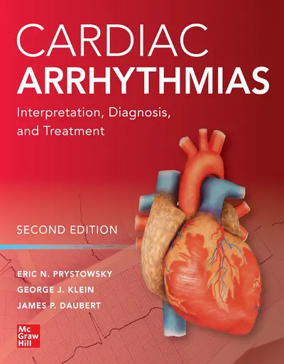 Cardiac Arrhythmias: Interpretation, Diagnosis and Treatment, Second Edition Cardiac Arrhythmias: Interpretation, Diagnosis and Treatment, Second Edition
