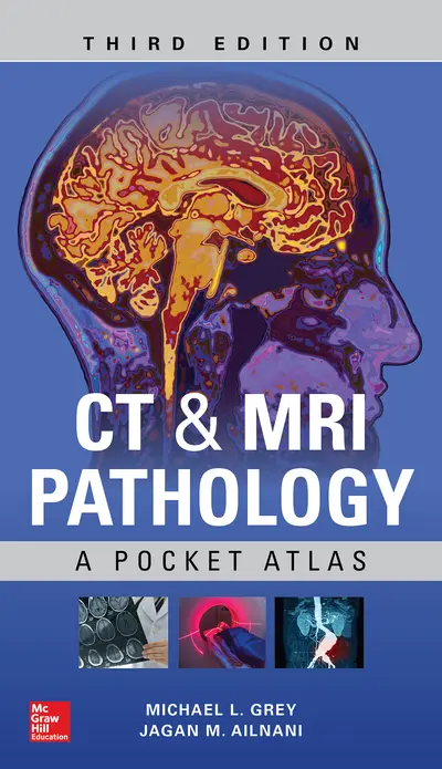 CT & MRI Pathology: A Pocket Atlas, Third Edition CT & MRI Pathology: A Pocket Atlas, Third Edition