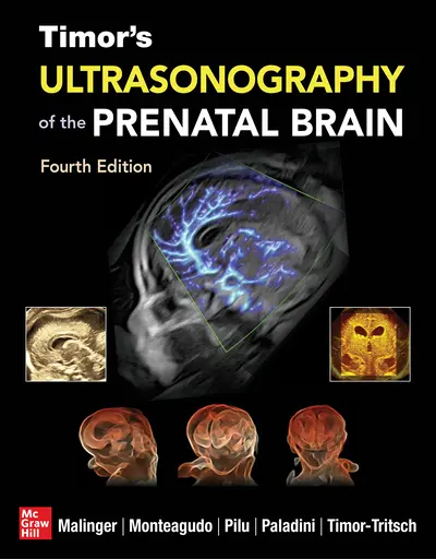 Timor's Ultrasonography of the Prenatal Brain, Fourth Edition Timor's Ultrasonography of the Prenatal Brain, Fourth Edition