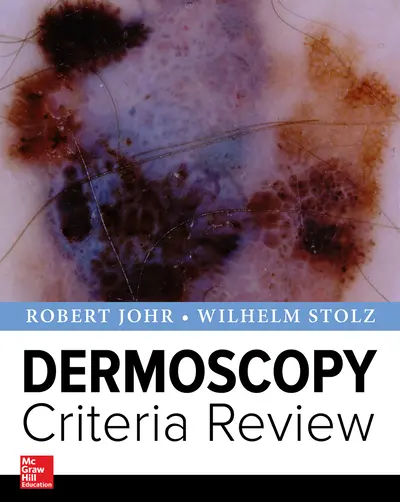 Dermoscopy Criteria Review Dermoscopy Criteria Review