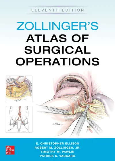 Zollinger's Atlas of Surgical Operations, Eleventh Edition Zollinger's Atlas of Surgical Operations, Eleventh Edition