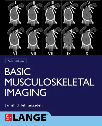 Basic Musculoskeletal Imaging, Second Edition Basic Musculoskeletal Imaging, Second Edition