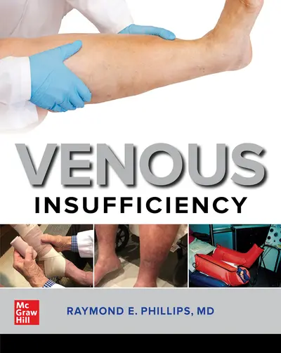 Venous Insufficiency Venous Insufficiency