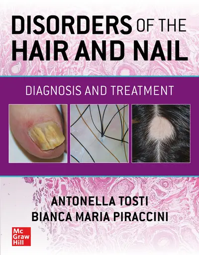 Disorders of the Hair and Nail: Diagnosis and Treatment Disorders of the Hair and Nail: Diagnosis and Treatment