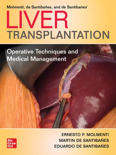 Liver Transplantation: Operative Techniques and Medical Management Liver Transplantation: Operative Techniques and Medical Management