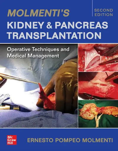 Molmenti's Kidney and Pancreas Transplantation: Operative Techniques and Medical Management Molmenti's Kidney and Pancreas Transplantation: Operative Techniques and Medical Management