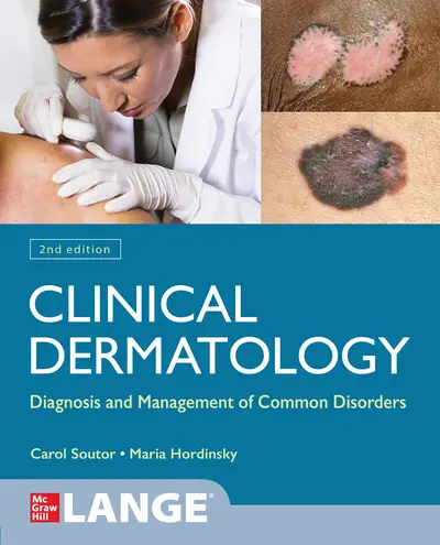 Clinical Dermatology: Diagnosis and Management of Common Disorders, Second Edition Clinical Dermatology: Diagnosis and Management of Common Disorders, Second Edition