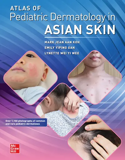 Atlas of Pediatric Dermatology in Asian Skin Atlas of Pediatric Dermatology in Asian Skin