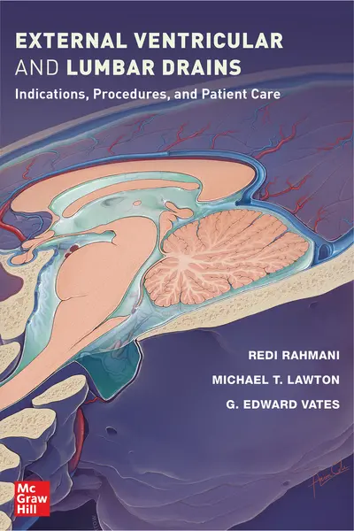 External Ventricular and Lumbar Drains: Indications, Procedures, and Patient Care External Ventricular and Lumbar Drains: Indications, Procedures, and Patient Care