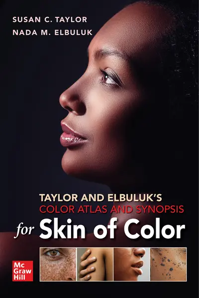 Taylor and Elbuluk's Color Atlas and Synopsis for Skin of Color Taylor and Elbuluk's Color Atlas and Synopsis for Skin of Color